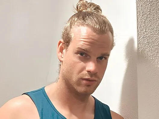 hair-transplant-after-2700-grafts